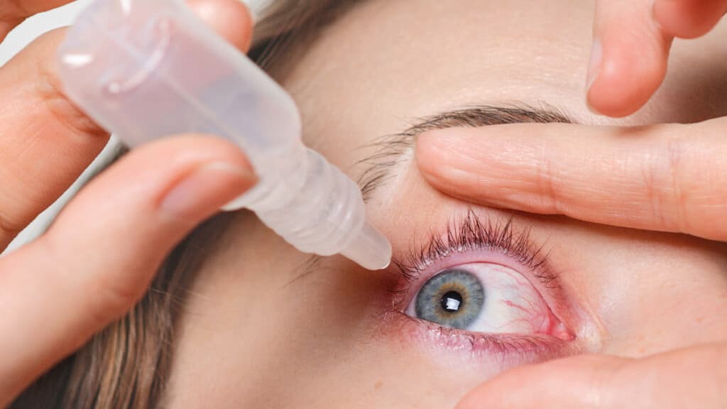 O que é Glaucoma: Causas, Sintomas e Como Tratar