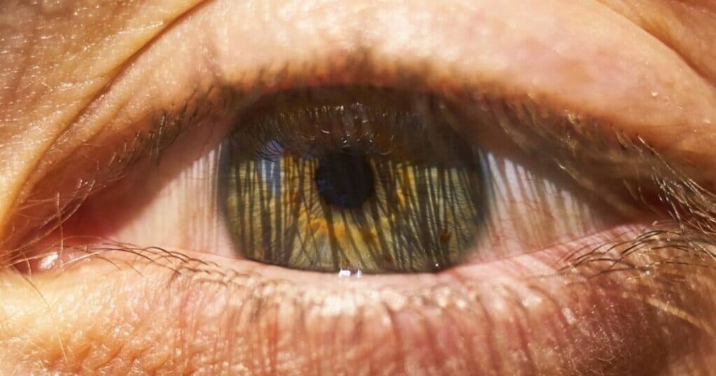 Descolamento de retina: sintomas de emergência e cirurgia